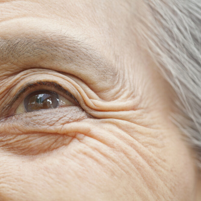Blog: Mensen met dementie. Zien wij niet wat we verwachten te zien?